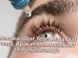 Kontroversi Penggunaan Obat Tetes Mata Ketika Sedang Berpuasa